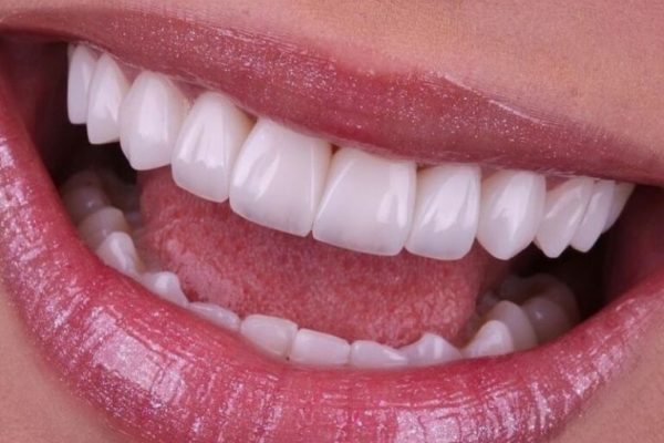 xr:d:DAF54Yb7D7g:5,j:4297975429516898394,t:24011417